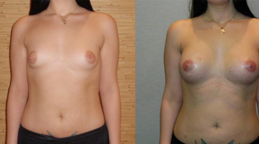 С помощью каких упражнений можно увеличить грудь. Особенности домашних тренировок по увеличению груди